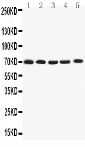 Anti-Kv1.4 antibody, PA2297, All Western blotting All lanes: Anti-KCNA4(PA2297) at 0.5ug/ml