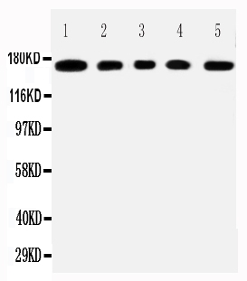 Anti-MUC1 antibody, PA2302, All Western blotting All lanes: Anti-MUCIN1(PA2302) at 0.5ug/ml