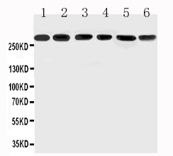 Anti-Mucin 5AC antibody, PA2303, All Western blotting All lanes: Anti-MUC5AC(PA2303) at0.5ug/ml Lane 1: SGC Whole Cell Lysate at 40ug Lane 2: HELA Whole Cell Lysate at 40ug Lane 3: COLO320 Whole Cell Lysate at 40ug Lane 4: SW620 Whole Cell Lysate at 40ug Lane 5: MCF-7 Whole Cell Lysate at 40ug Lane 6: PANC Whole Cell Lysate at 40ug Predicted bind size: 527KD Observed bind size: 300KD