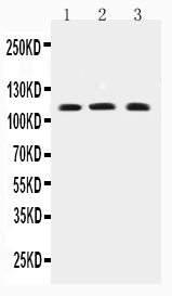 Anti-TRPC4 antibody, PA2307, All Western blotting All lanes: Anti-TRPC4(PA2307) at 0.5ug/ml