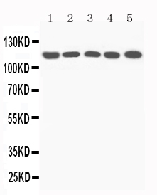 Anti-C5/C5a antibody, PA2308, All Western blotting All lanes: Anti-C5a(PA2308) at 0.5ug/ml