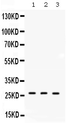 Western blot analysis of DDAH2 using anti-DDAH2 antibody (PB10001).