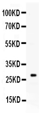 Western blot analysis of Kallikrein 8 using anti-Kallikrein 8 antibody (PB10005).