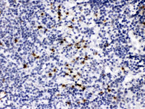 IHC analysis of MMP-9 using anti-MMP-9 antibody (PB10008).