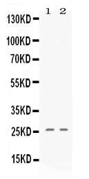 Western blot analysis of PF4 using anti-PF4 antibody (PB10011).