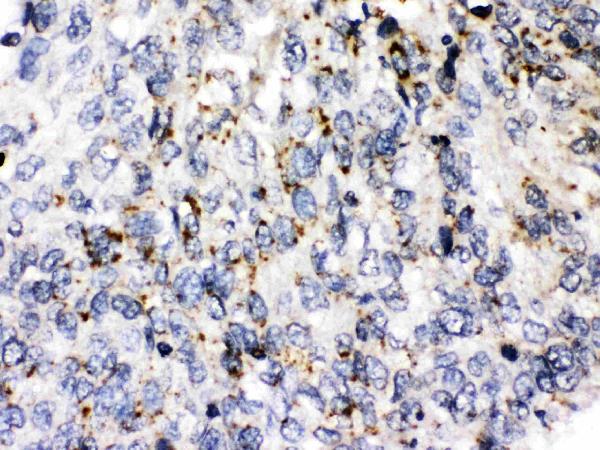 IHC analysis of Perilipin 3 using anti-Perilipin 3 antibody (PB10013).