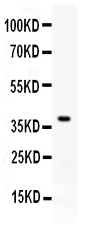 Western blot analysis of RANKL using anti-RANKL antibody (PB10015).