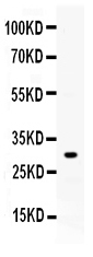 Western blot analysis of ZWINT using anti-ZWINT antibody (PB10018).