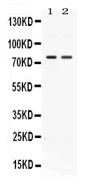 Western blot analysis of ACVR2A using anti-ACVR2A antibody (PB10027).