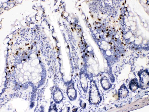 IHC analysis of AKR1B1 using anti-AKR1B1 antibody (PB10035). AKR1B1 was detected in paraffin-embedded section of rat intestine tissues. Heat mediated antigen retrieval was performed in citrate buffer (pH6, epitope retrieval solution) for 20 mins. The tissue section was blocked with 10% goat serum. The tissue section was then incubated with 1μg/ml rabbit anti-AKR1B1 Antibody (PB10035) overnight at 4°C. Biotinylated goat anti-rabbit IgG was used as secondary antibody and incubated for 30 minutes at 37°C. The tissue section was developed using Strepavidin-Biotin-Complex (SABC)(Catalog # SA1022) with DAB as the chromogen.