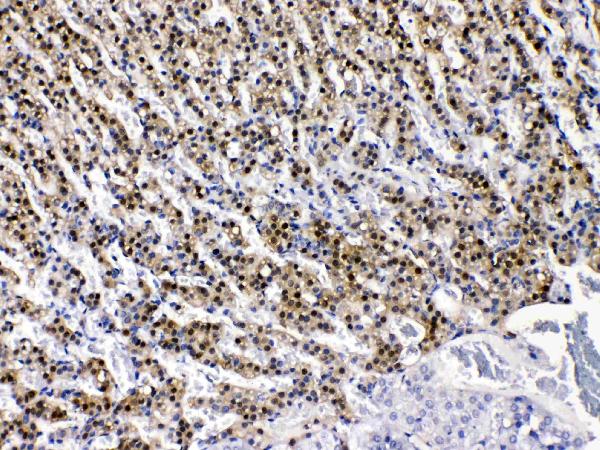 IHC analysis of AKR1B1 using anti-AKR1B1 antibody (PB10035). AKR1B1 was detected in paraffin-embedded section of rat adrenal gland tissues. Heat mediated antigen retrieval was performed in citrate buffer (pH6, epitope retrieval solution) for 20 mins. The tissue section was blocked with 10% goat serum. The tissue section was then incubated with 1μg/ml rabbit anti-AKR1B1 Antibody (PB10035) overnight at 4°C. Biotinylated goat anti-rabbit IgG was used as secondary antibody and incubated for 30 minutes at 37°C. The tissue section was developed using Strepavidin-Biotin-Complex (SABC)(Catalog # SA1022) with DAB as the chromogen.