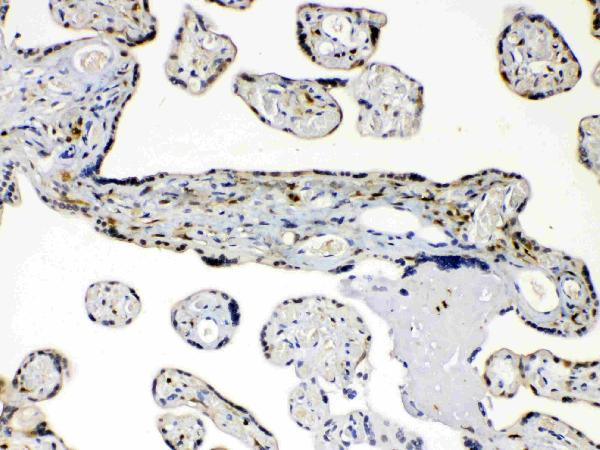 IHC analysis of AKR1B1 using anti-AKR1B1 antibody (PB10035). AKR1B1 was detected in paraffin-embedded section of human placenta tissues. Heat mediated antigen retrieval was performed in citrate buffer (pH6, epitope retrieval solution) for 20 mins. The tissue section was blocked with 10% goat serum. The tissue section was then incubated with 1μg/ml rabbit anti-AKR1B1 Antibody (PB10035) overnight at 4°C. Biotinylated goat anti-rabbit IgG was used as secondary antibody and incubated for 30 minutes at 37°C. The tissue section was developed using Strepavidin-Biotin-Complex (SABC)(Catalog # SA1022) with DAB as the chromogen.