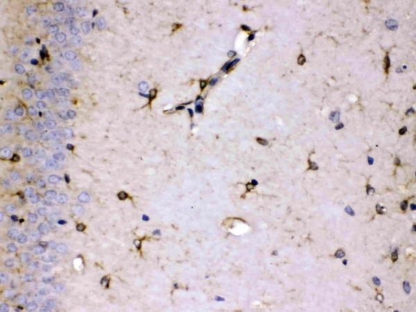 IHC analysis of ALDH7A1 using anti-ALDH7A1 antibody (PB10038). ALDH7A1 was detected in paraffin-embedded section of rat brain tissues. Heat mediated antigen retrieval was performed in citrate buffer (pH6, epitope retrieval solution) for 20 mins. The tissue section was blocked with 10% goat serum. The tissue section was then incubated with 1μg/ml rabbit anti-ALDH7A1 Antibody (PB10038) overnight at 4°C. Biotinylated goat anti-rabbit IgG was used as secondary antibody and incubated for 30 minutes at 37°C. The tissue section was developed using Strepavidin-Biotin-Complex (SABC)(Catalog # SA1022) with DAB as the chromogen.