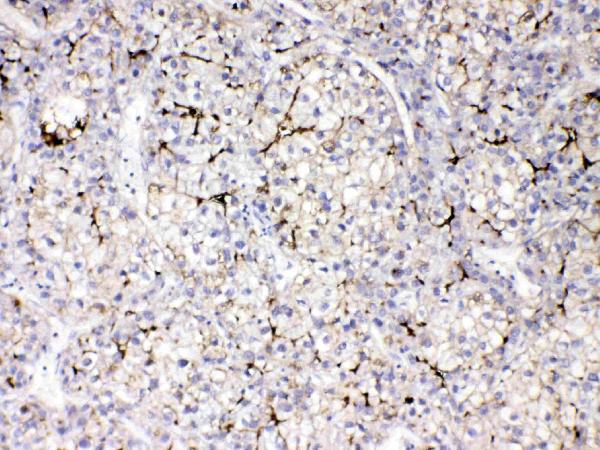 IHC analysis of Apolipoprotein CIII using anti-Apolipoprotein CIII antibody (PB10042).