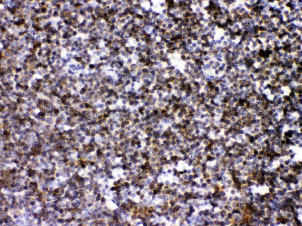 IHC analysis of ARHGEF1 using anti-ARHGEF1 antibody (PB10045).