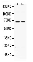 Western blot analysis of ACCN1 using anti-ACCN1 antibody (PB10046).