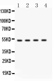 Western blot analysis of BDKRB2 using anti-BDKRB2 antibody (PB10047).