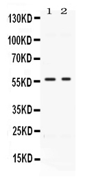 Western blot analysis of BMP15 using anti-BMP15 antibody (PB10048).