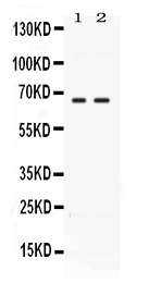 Western blot analysis of CCDC6 using anti-CCDC6 antibody (PB10050).