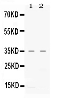 Western blot analysis of CXCL16 using anti-CXCL16 antibody (PB10054).