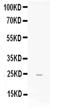 Western blot analysis of FGF19 using anti-FGF19 antibody (PB10061).