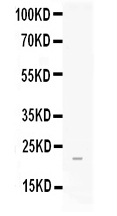 Western blot analysis of FGF21 using anti-FGF21 antibody (PB10063). Electrophoresis was performed on a 5-20% SDS-PAGE gel at 70V (Stacking gel) / 90V (Resolving gel) for 2-3 hours. The sample well of each lane was loaded with 50ug of sample under reducing conditions. Lane 1: human placenta tissue lysates, After Electrophoresis, proteins were transferred to a Nitrocellulose membrane at 150mA for 50-90 minutes. Blocked the membrane with 5% Non-fat Milk/ TBS for 1.5 hour at RT. The membrane was incubated with rabbit anti-FGF21 antigen affinity purified polyclonal antibody (Catalog # PB10063) at 0.5 μg/mL overnight at 4°C, then washed with TBS-0.1%Tween 3 times with 5 minutes each and probed with a goat anti-rabbit IgG-HRP secondary antibody at a dilution of 1:10000 for 1.5 hour at RT. The signal is developed using an Enhanced Chemiluminescent detection (ECL) kit (Catalog # EK1002) with Tanon 5200 system. A specific band was detected for FGF21 at approximately 22KD. The expected band size for FGF21 is at 22KD.