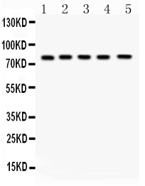 Western blot analysis of FSH Receptor using anti-FSH Receptor antibody (PB10065).