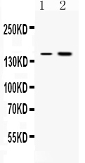 Western blot analysis of Insulin Receptor using anti-Insulin Receptor antibody (PB10072).