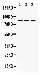 Western blot analysis of KRIT1 using anti-KRIT1 antibody (PB10074).