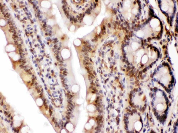 IHC analysis of LDHB using anti-LDHB antibody (PB10075).