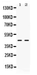 Western blot analysis of NR2F6 using anti-NR2F6 antibody (PB10081).