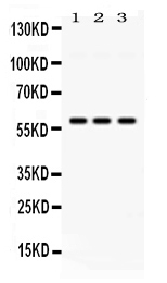 Western blot analysis of PIAS4 using anti-PIAS4 antibody (PB10082).