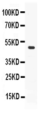 Western blot analysis of ADFP using anti-ADFP antibody (PB10083).