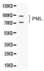 Western blot analysis of PML Protein using anti-PML Protein antibody (PB10085).