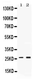 Western blot analysis of PSMA2 using anti-PSMA2 antibody (PB10088).