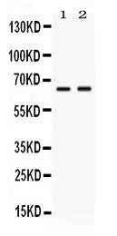 Western blot analysis of Nectin-4/PVRL4 using anti-Nectin-4/PVRL4 antibody (PB10091).