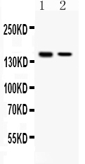 Western blot analysis of SAFB using anti-SAFB antibody (PB10095).