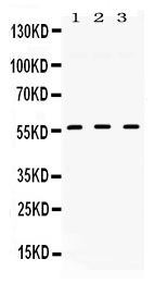 Western blot analysis of TGFBR1 using anti-TGFBR1 antibody (PB10101).