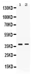 Western blot analysis of TNFRSF14/HVEM using anti-TNFRSF14/HVEM antibody (PB10104).