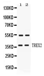 Western blot analysis of TREX2 using anti-TREX2 antibody (PB10105).