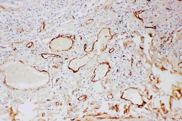 IHC analysis of Adiponectin using anti-Adiponectin antibody (PB9001).