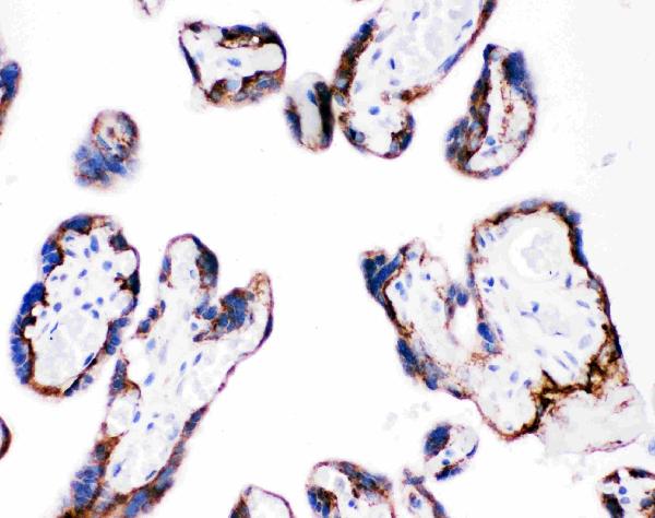 IHC analysis of ITGB4 using anti-ITGB4 antibody (PB9007). ITGB4 was detected in paraffin-embedded section of human placenta tissues. Heat mediated antigen retrieval was performed in citrate buffer (pH6, epitope retrieval solution) for 20 mins. The tissue section was blocked with 10% goat serum. The tissue section was then incubated with 1μg/ml rabbit anti-ITGB4 Antibody (PB9007) overnight at 4°C. Biotinylated goat anti-rabbit IgG was used as secondary antibody and incubated for 30 minutes at 37°C. The tissue section was developed using Strepavidin-Biotin-Complex (SABC)(Catalog # SA1022) with DAB as the chromogen.