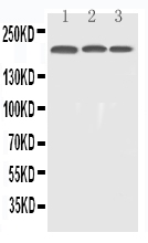 Western blot analysis of EGFR using anti-EGFR antibody (PB9016).