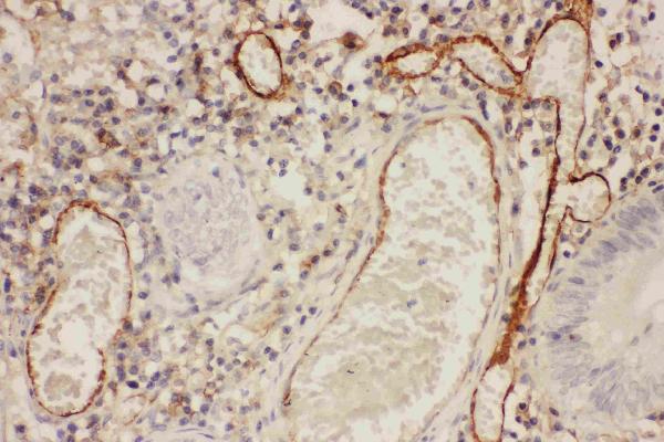 IHC analysis of ICAM1 using anti-ICAM1 antibody (PB9017).