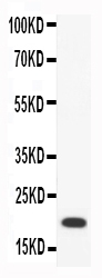 Western blot analysis of CCL18 using anti-CCL18 antibody (PB9023).