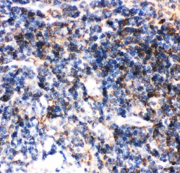 IHC analysis of BID using anti-BID antibody (PB9027). BID was detected in paraffin-embedded section of mouse spleen tissues. Heat mediated antigen retrieval was performed in citrate buffer (pH6, epitope retrieval solution) for 20 mins. The tissue section was blocked with 10% goat serum. The tissue section was then incubated with 1μg/ml rabbit anti-BID Antibody (PB9027) overnight at 4°C. Biotinylated goat anti-rabbit IgG was used as secondary antibody and incubated for 30 minutes at 37°C. The tissue section was developed using Strepavidin-Biotin-Complex (SABC)(Catalog # SA1022) with DAB as the chromogen.