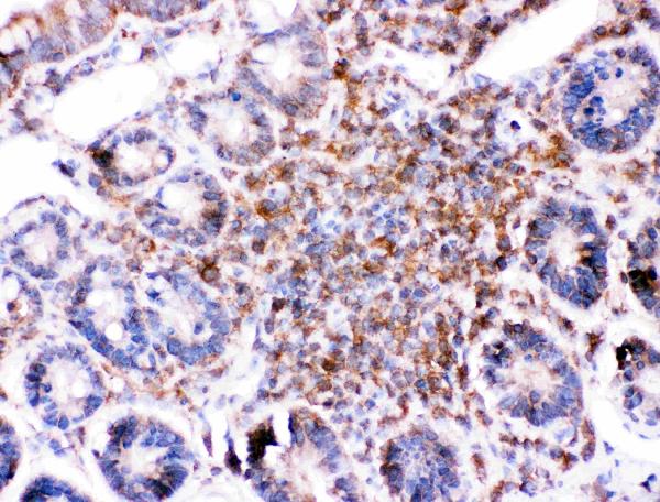 IHC analysis of BID using anti-BID antibody (PB9027). BID was detected in paraffin-embedded section of rat intestine tissues. Heat mediated antigen retrieval was performed in citrate buffer (pH6, epitope retrieval solution) for 20 mins. The tissue section was blocked with 10% goat serum. The tissue section was then incubated with 1μg/ml rabbit anti-BID Antibody (PB9027) overnight at 4°C. Biotinylated goat anti-rabbit IgG was used as secondary antibody and incubated for 30 minutes at 37°C. The tissue section was developed using Strepavidin-Biotin-Complex (SABC)(Catalog # SA1022) with DAB as the chromogen.