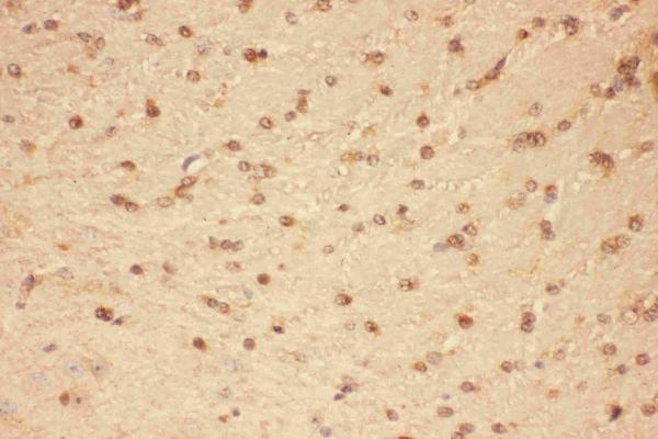 IHC analysis of CNTF using anti-CNTF antibody (PB9032).