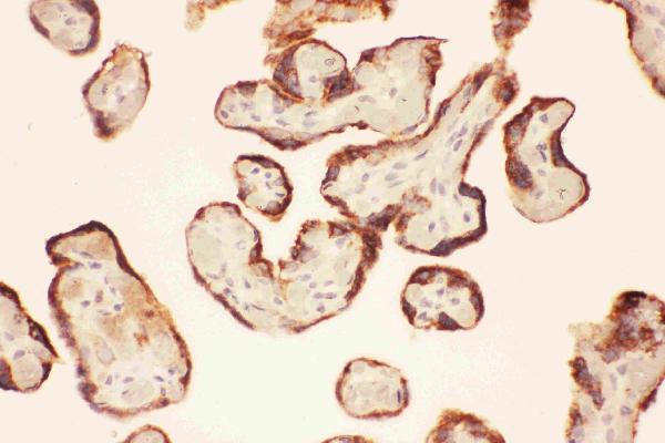 IHC analysis of LIF using anti-LIF antibody (PB9036). LIF was detected in paraffin-embedded section of human placenta tissues. Heat mediated antigen retrieval was performed in citrate buffer (pH6, epitope retrieval solution) for 20 mins. The tissue section was blocked with 10% goat serum. The tissue section was then incubated with 1μg/ml rabbit anti-LIF Antibody (PB9036) overnight at 4°C. Biotinylated goat anti-rabbit IgG was used as secondary antibody and incubated for 30 minutes at 37°C. The tissue section was developed using Strepavidin-Biotin-Complex (SABC)(Catalog # SA1022) with DAB as the chromogen.