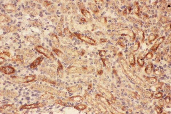 IHC analysis of MMP7 using anti-MMP7 antibody (PB9038).